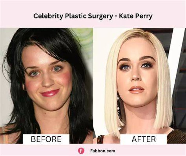Pierre Coffin's Appearance Before Plastic Surgery Revealed
